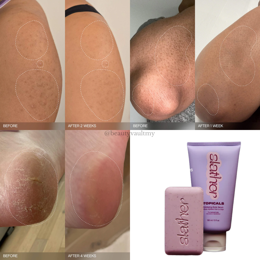 Slather Exfoliating & Smoothing Bar (2 Bars)